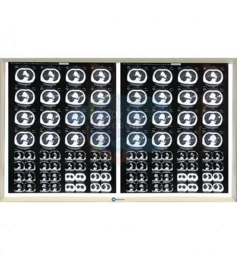 Негатоскоп LED 2-кадровый